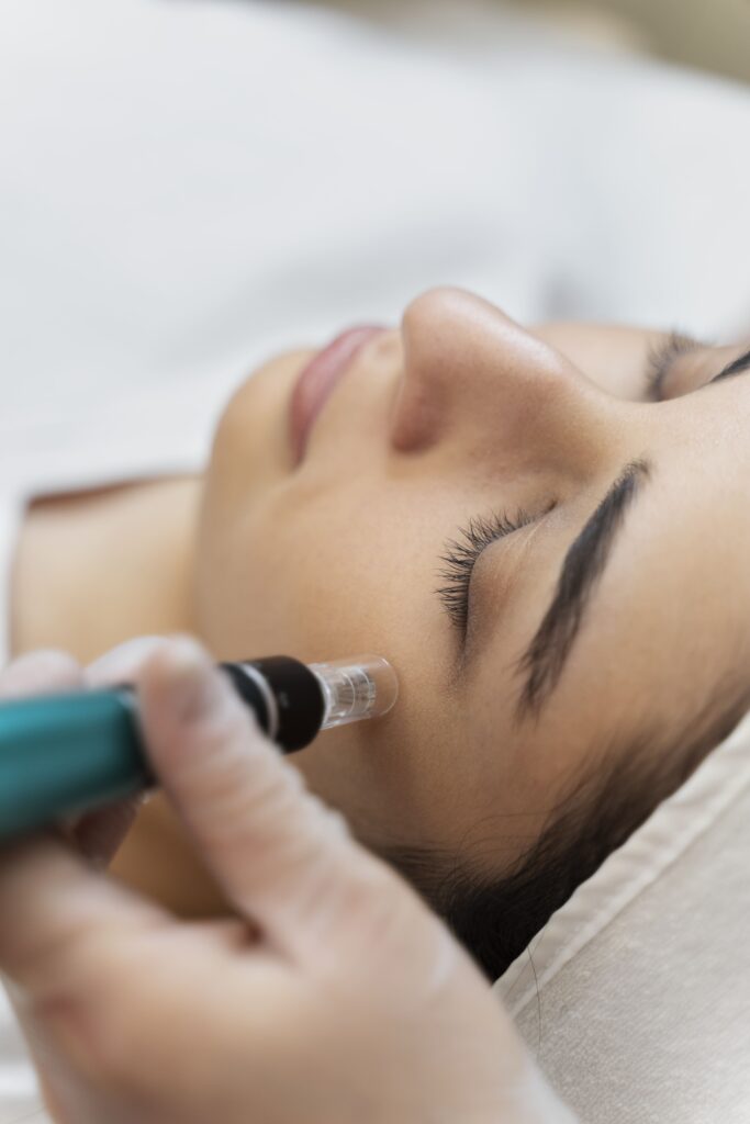 PORE SURGERY